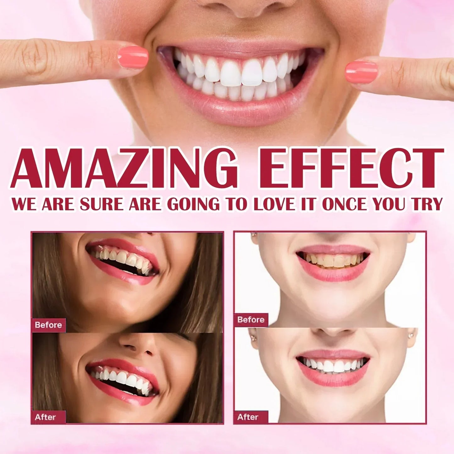 Yayashi SP4 Oral Care ProbioticToothpaste 120g – Shine , Remove Years of Coffee, Tea & Smoking Stains